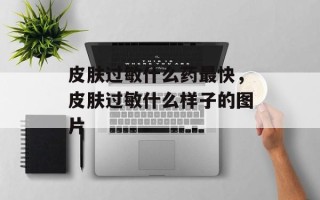 皮肤过敏什么药最快，皮肤过敏什么样子的图片